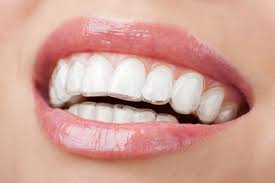 Con Invisalign puedes evitar el dolor de encías en la masticación